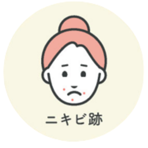 ニキビ跡