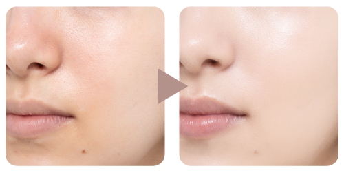 ビフォーアフター